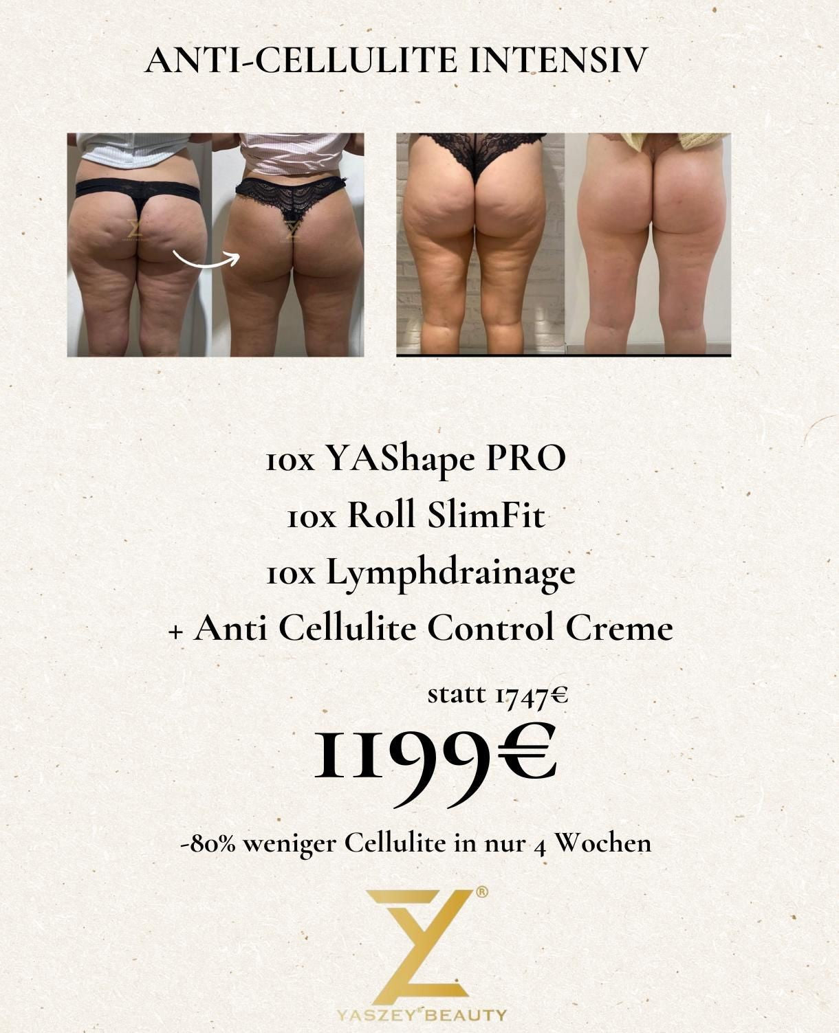Paket 3 - Anti Cellulite Intensiv - (10x) YAShape Pro, Roll SlimFit, Lymphdrainage + Anti Cellulite Control Creme