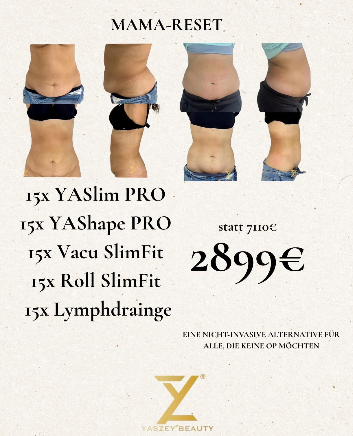 Paket 8 - Mama Reset - (15x) YASlim Pro, YAShape Pro, Vacu SlimFit, Roll SlimFit, Lymphdrainage