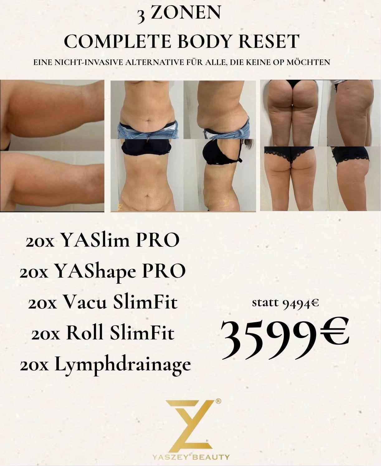 Paket 9 - Complete Body Reset - (20x) YASlim Pro, YAShape Pro, Vacu SlimFit, Roll SlimFit, Lymphdrainage