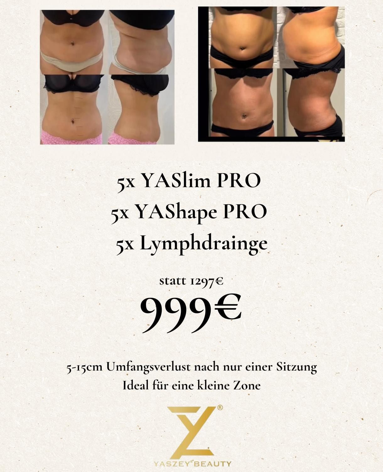 Paket 1 - Kleine-Zonen-Paket - (5x) YASlim Pro, YAShape Pro, Lymphdrainage