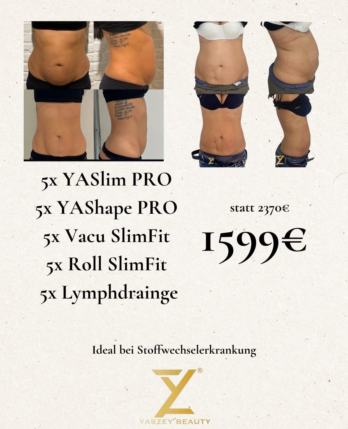 Paket 4 - Ideal für Stoffwechselerkrankungen - (5x) YASlim Pro, YAShape Pro, Vacu SlimFit, Roll SlimFit, Lymphdrainage