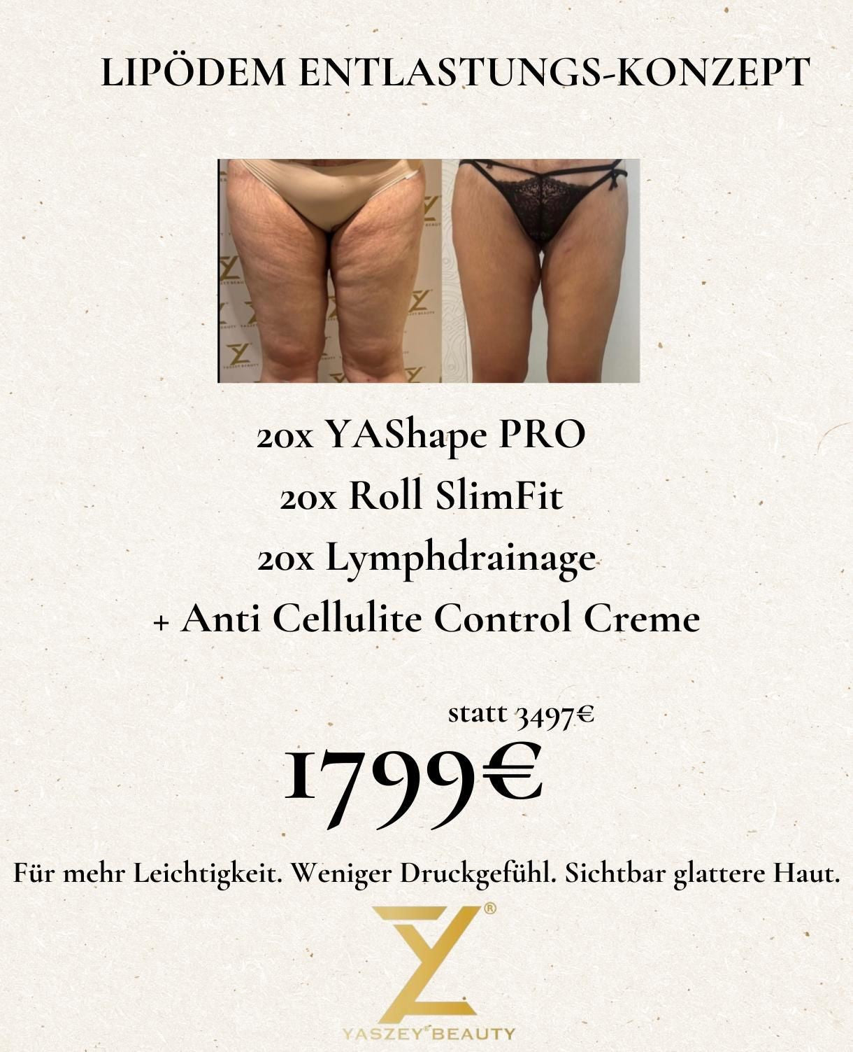 Paket 6  - Lipödem Entlastungskonzept - (20x) YAShape Pro, Roll SlimFit, Lymphdrainage + Anti Cellulite Control Creme